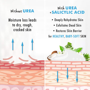 Urea Cream 40% Plus Salicylic Acid 4.6 Oz, Callus Remover Hand Cream Foot Cream For Dry Cracked Feet, Hands, Heels, Elbows, Nails, Knees, Intensive Moisturizes & Softens Skin, Exfoliates Dead Skin