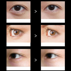 Adofect 30 Pairs Black Collagen Under Eye Mask Anti-Aging Hyaluronic Acid Eye Patches for Moisturizing & Reducing Dark Circles, Luxury Gift for Women and Men, Black