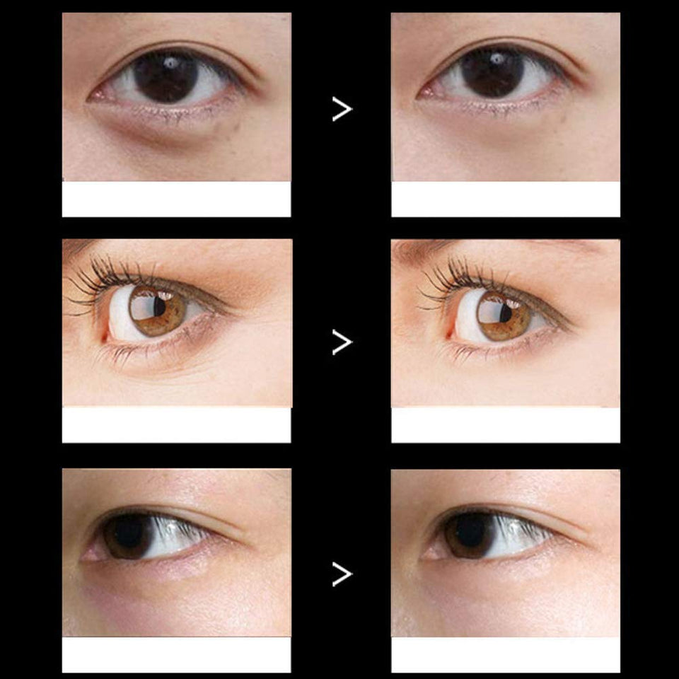 Adofect 30 Pairs Black Collagen Under Eye Mask Anti-Aging Hyaluronic Acid Eye Patches for Moisturizing & Reducing Dark Circles, Luxury Gift for Women and Men, Black