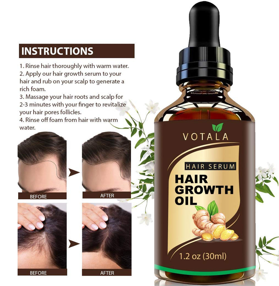 Hair Growth Serum, VOTALA Hair Growth Treatment, Anti Hair Loss, Promotes Thicker, Stronger Hair, And Hair Regrowth for Men Women